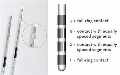 Using Directional Deep Brain Stimulation to Co-activate the Subthalamic Nucleus and Zona Incerta for Overlapping Essential Tremor/Parkinson's Disease Symptoms